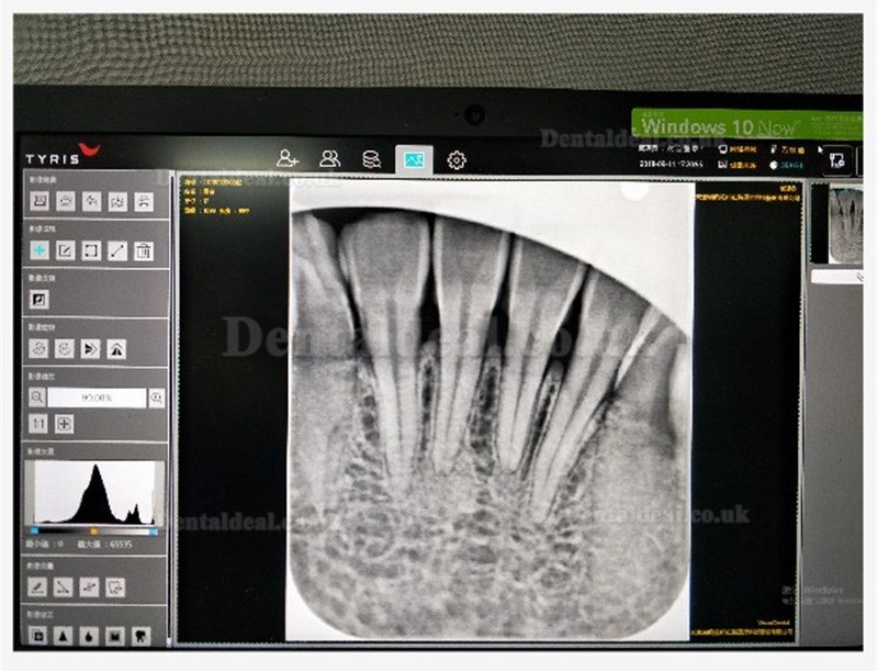 TYRIS TR-100 Dental Intraoral CR Imaging Plate Scanner PSP X ray Scanner for Dental Practice